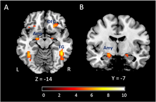 Illustration for article titled Is "Emotion Training" the Next Brain Training? Let's Hope Not